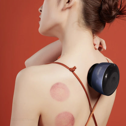 Zdeer Intelligent Cupping Massager – Rechargeable Vacuum Guasha Massage Device for Fatigue Relief