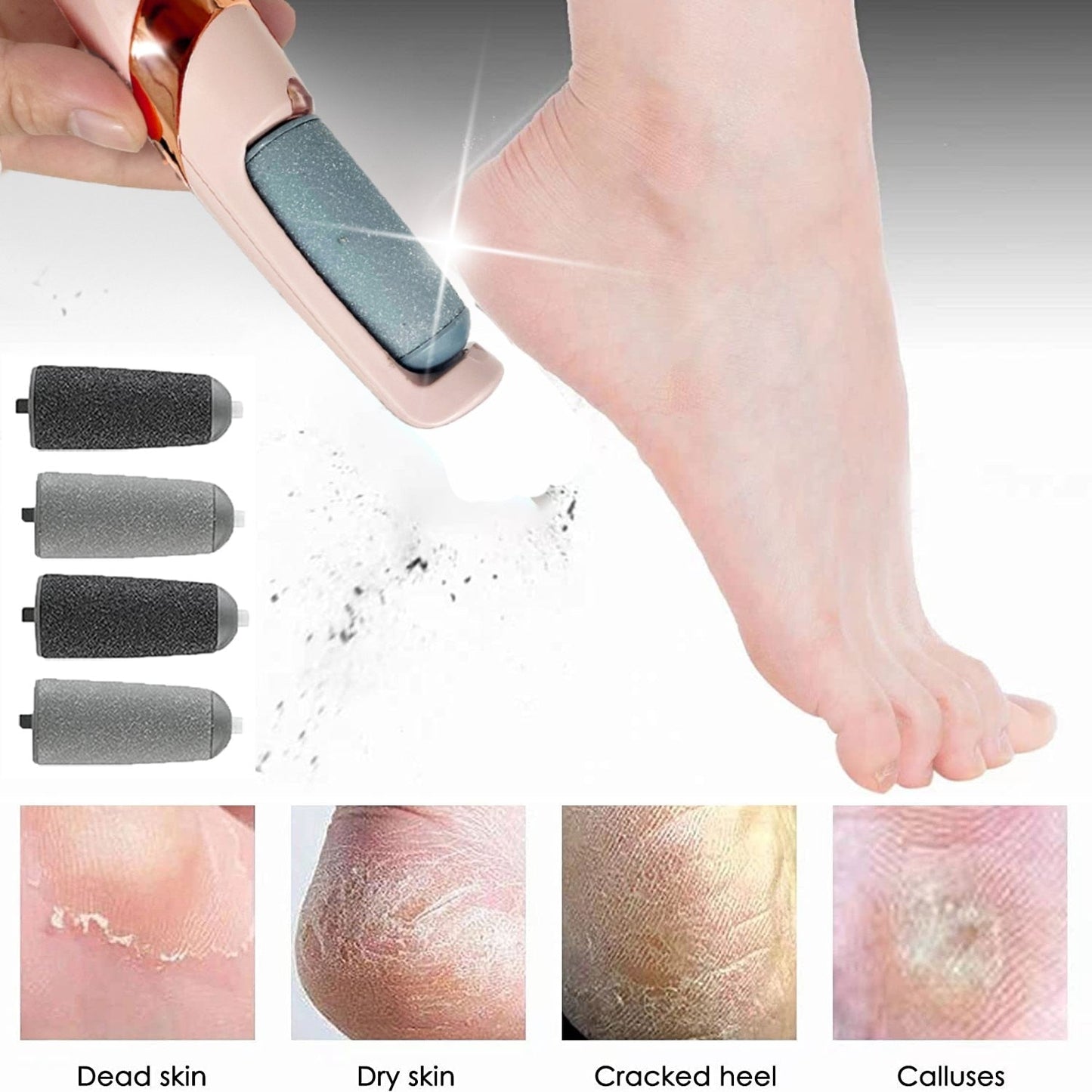 Royallure Professional Electric Foot Care System